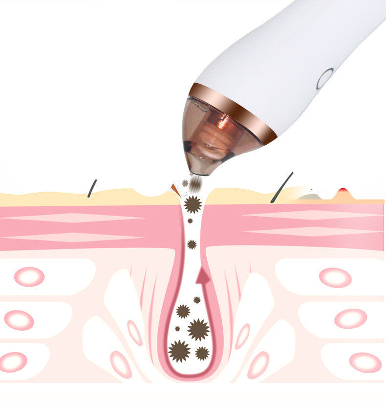 4-in-1 Facial & Body Blackhead Remover Device